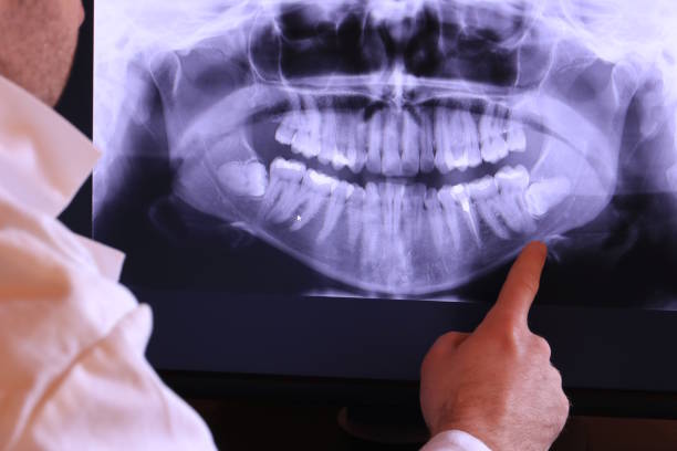Best Emergency Dental Care for Abscessed Tooth in Charlotte Park, FL